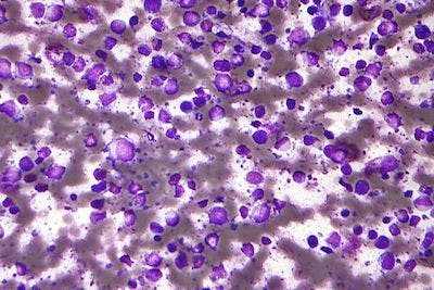 Molecular Classification for Lymphoma Revised by NIH