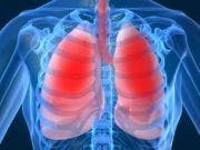FDA Approves New Treatment for Chronic Obstructive Pulmonary Disease