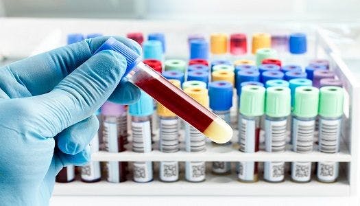 infectious disease, hepatitis C, HCV, hepatology, baby boomers, risk factors, antibody, blood test, CROI 2017