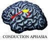 On the Relation Between Auditory-motor Area Spt and Conduction Aphasia 