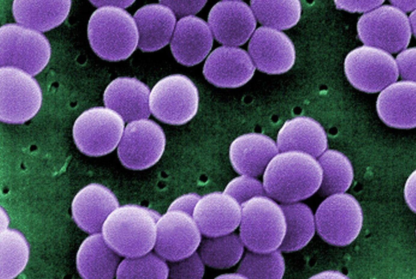 Universal Decolonization Significantly Lowers MRSA Rates in ICU Patients 