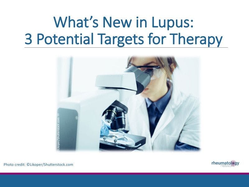What’s New in Lupus: 3 Potential Targets for Therapy