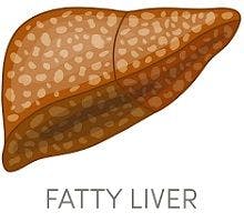 Gestational Diabetes Mellitus and Fatty Livers