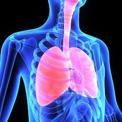 Removal of Race Correction for Pulmonary Function Testing Could Worsen Disparities in Lung Cancer Surgeries