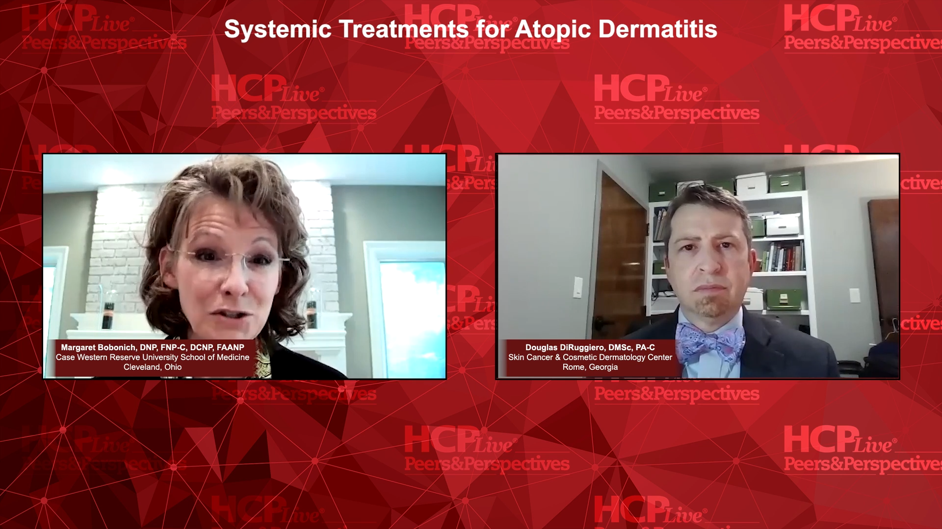 Systemic Treatments for Atopic Dermatitis 