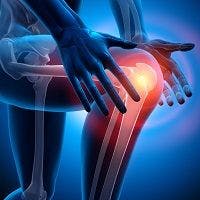 Osteoarthritis knee