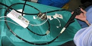 Data on Double Balloon Enteroscopy Shows it is Safe and Effective