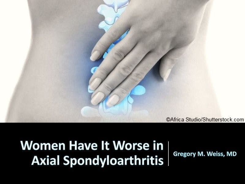 Women Have It Worse in Axial Spondyloarthritis