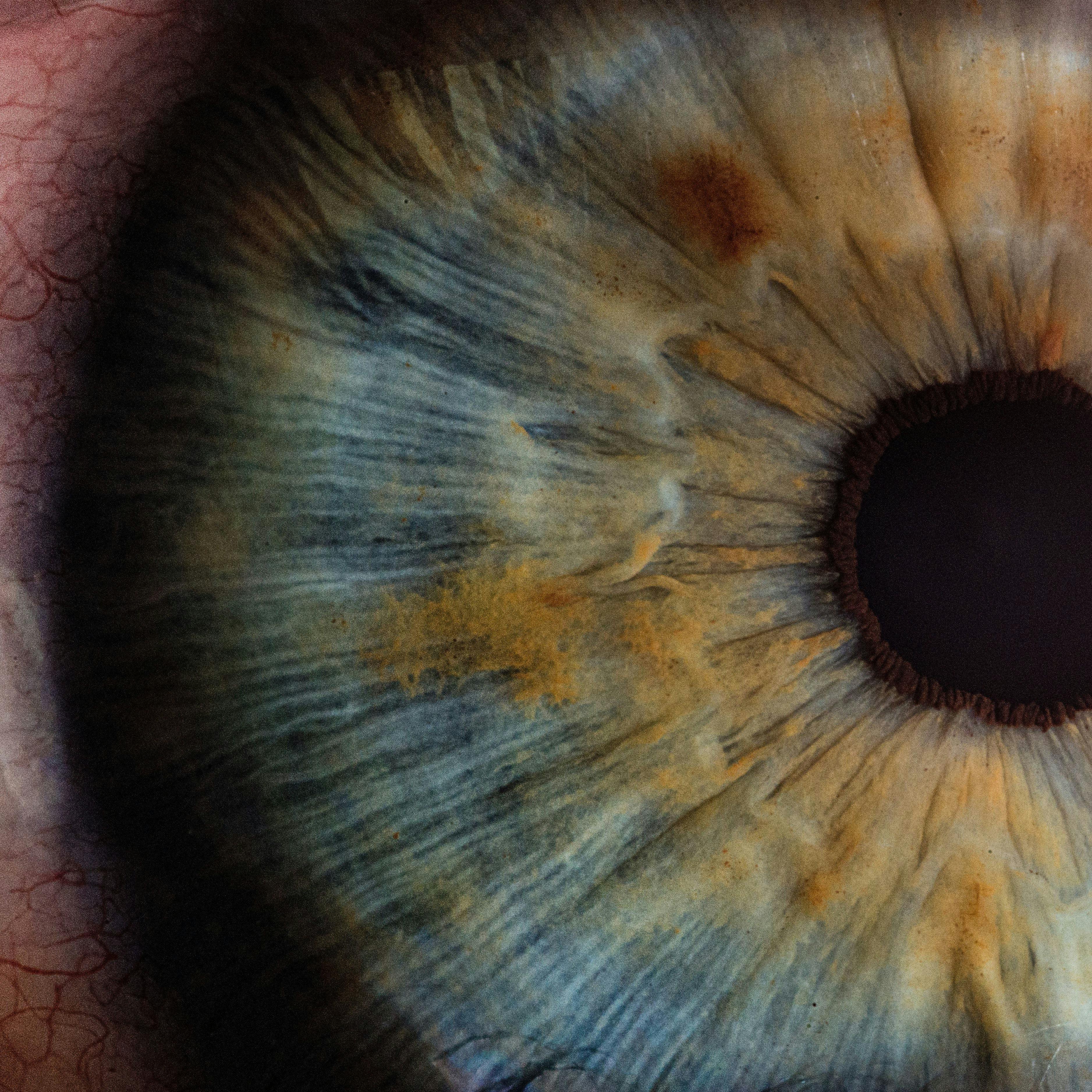 close-up of eye | Credit: v2osk/Unsplash