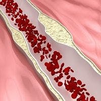 New Evidence Points to Potential Biomarker for Giant Cell Arteritis 