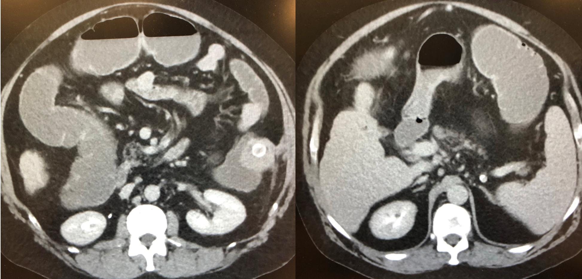 CT scan of a patient's abdomen.