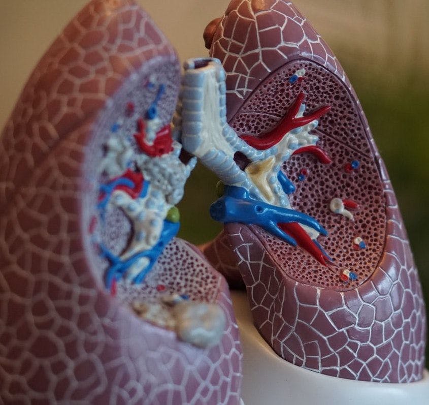 Proton Pump Inhibitors Linked to COPD Progression and Exacerbation