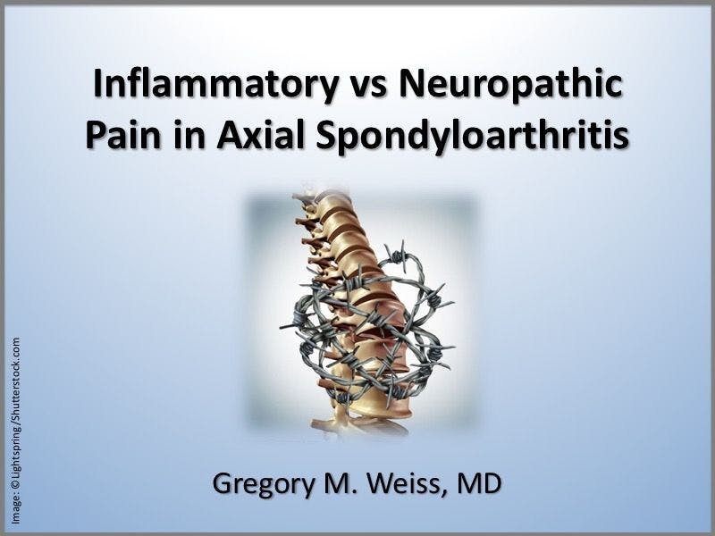 Inflammatory vs Neuropathic Pain in Axial Spondyloarthritis
