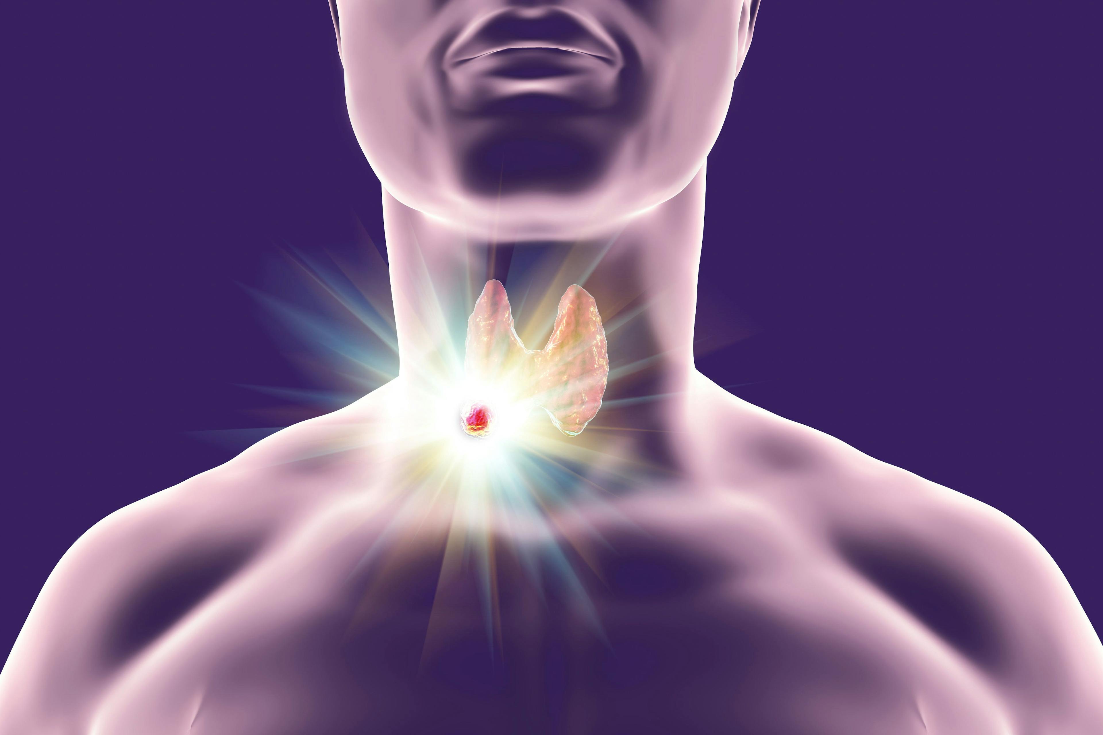 Study Finds Thyroid Inflammation Tied to Anxiety Disorders