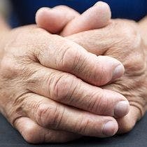 Is Rheumatoid Arthritis Really on the Decline?