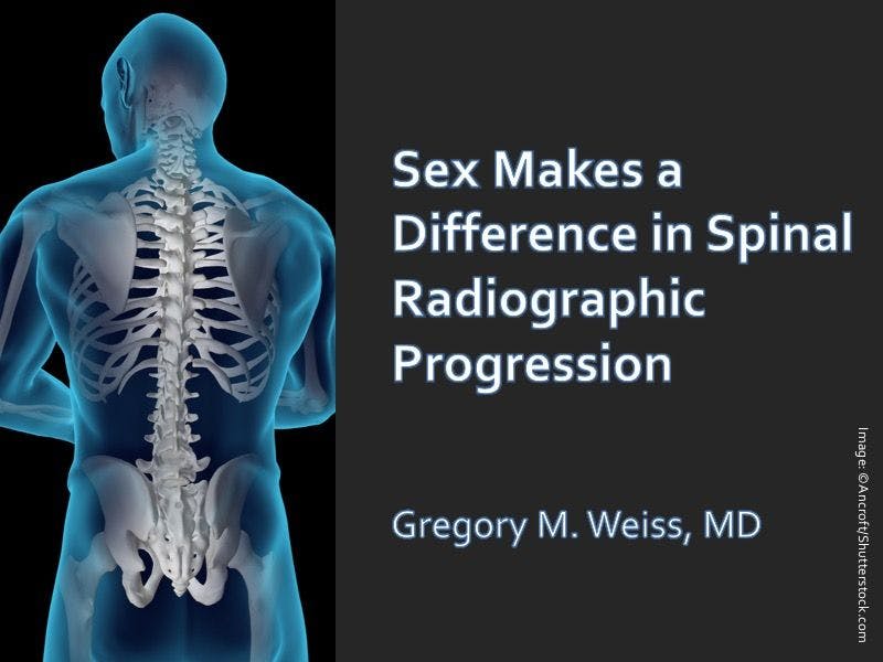 Sex Makes a Difference in Spinal Radiographic Progression