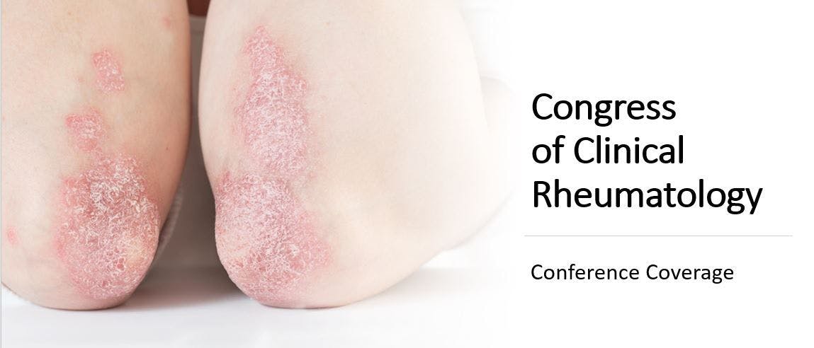 Congress of Clinical Rheumatology East 2020 meeting.