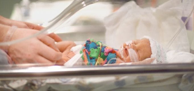 Brain Injury in Premature Babies Linked to Increased Autism Risk