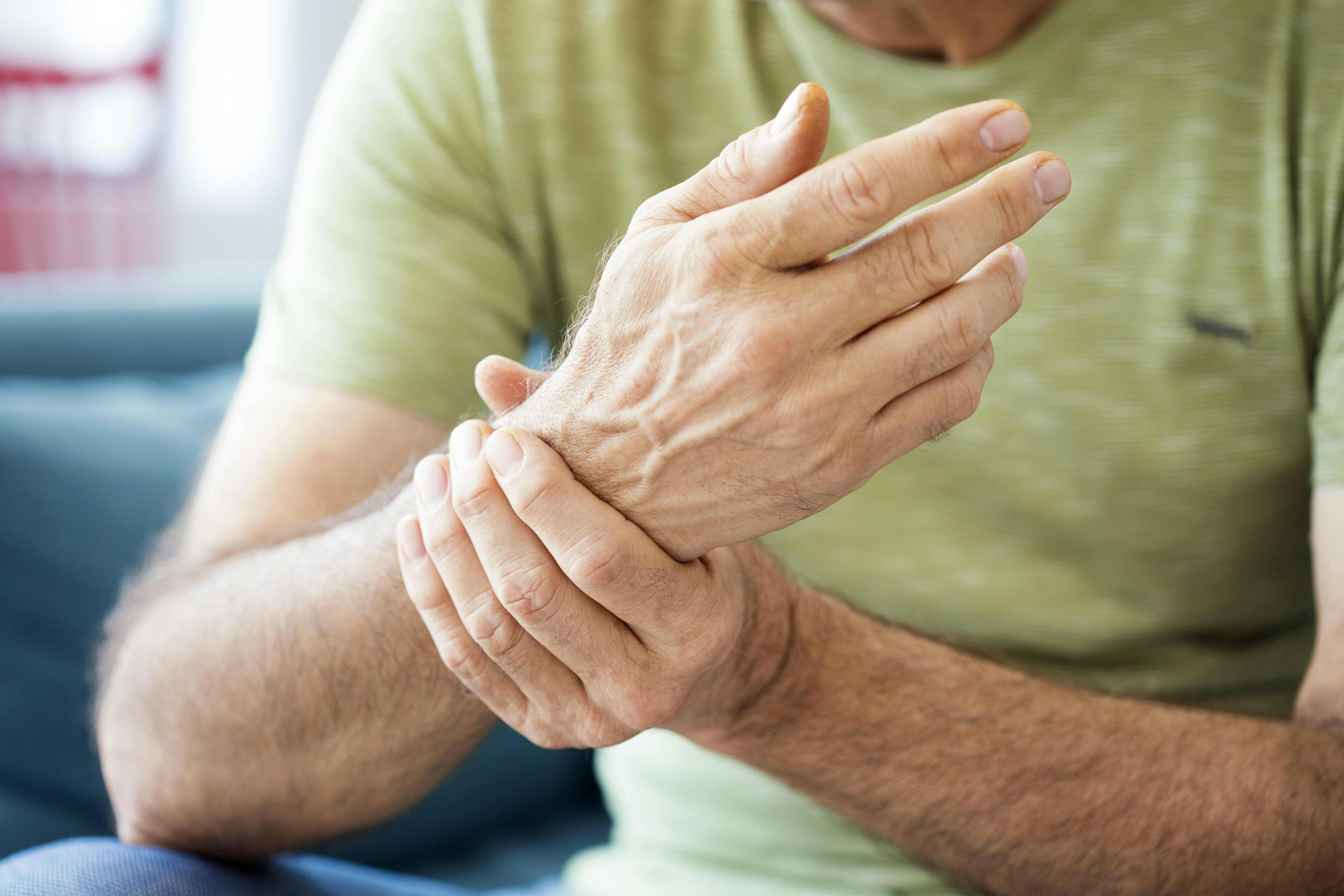 Close-up of arthritic hand