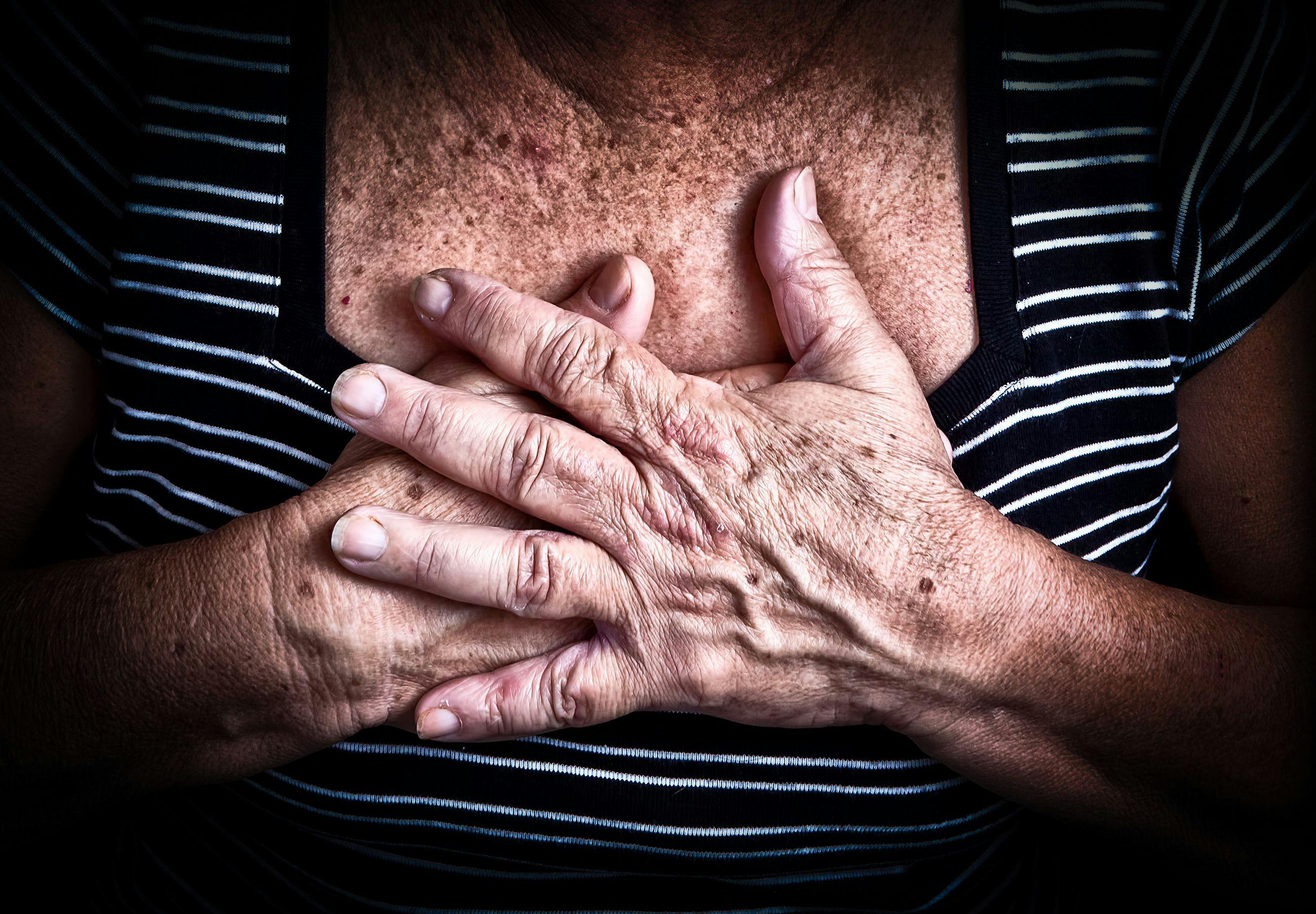 Heart Disease Often Missed in Rheumatoid Arthritis