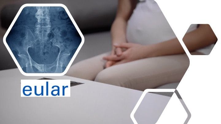 EULAR Report: Cesarean Deliveries Higher in Spondyloarthritis