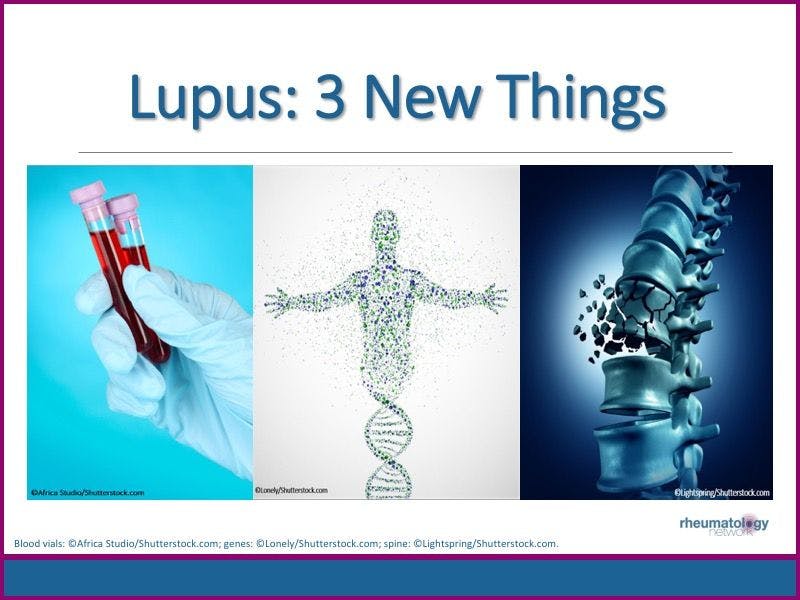 Lupus: 3 New Things