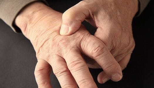 Stock image depicting an older person struggling with arthritis