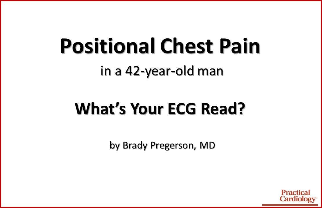 Case Quiz: Positional Chest Pain in a 42-year-old Man
