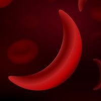 Patients with Sickle Cell Disease Exhibit a Distinct Metabolic Profile 