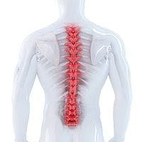 Spinal Cord Stimulation Can Treat Parkinson's Gait Symptoms