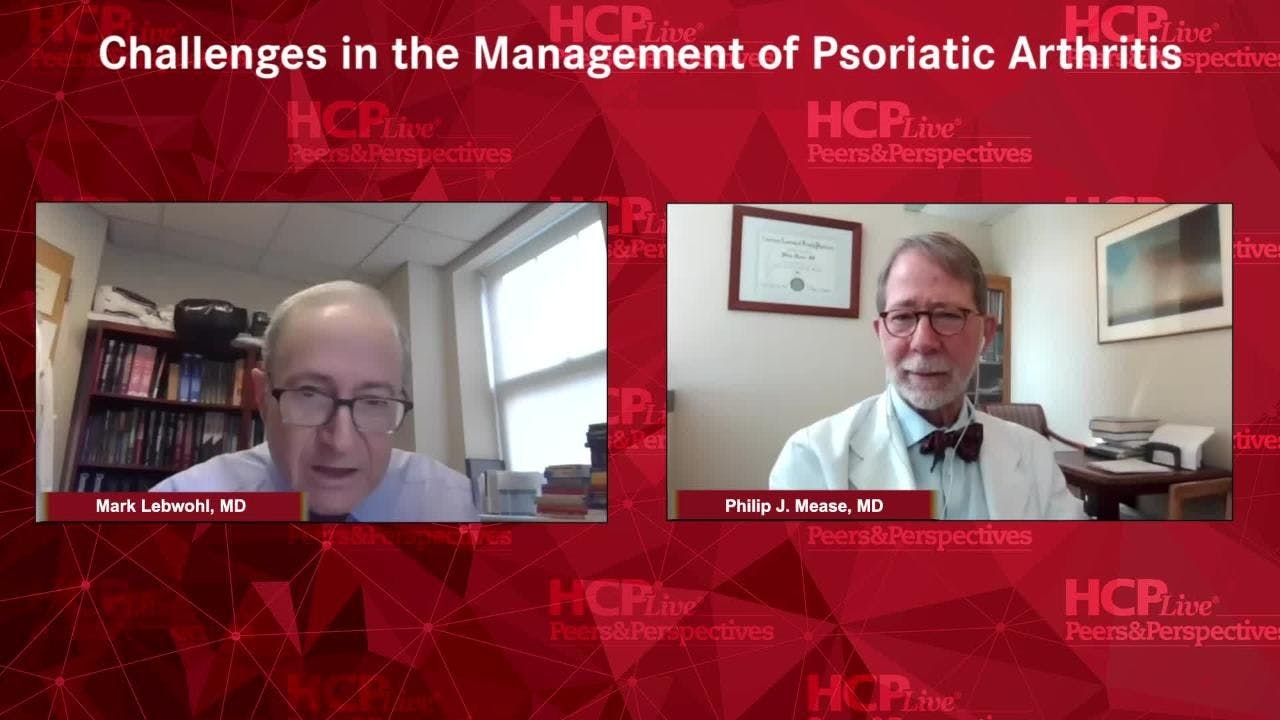 Challenges in the Management of Psoriatic Arthritis