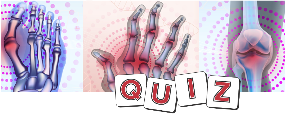 Rheumatoid Arthritis Quiz: Biologics