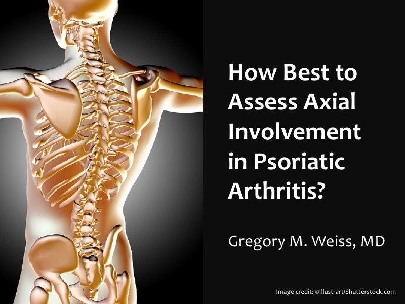 How Best to Assess Axial Involvement in Psoriatic Arthritis?