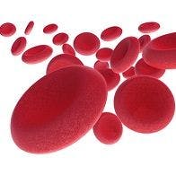 Anemia Increases Mortality Rate in Acute Stroke, According to Study