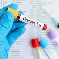 Potential Chlamydia Vaccine Would Be Administered Without a Needle