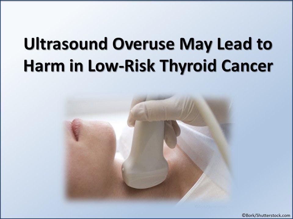 Ultrasound Overuse May Lead to Harm in Low-Risk Thyroid Cancer