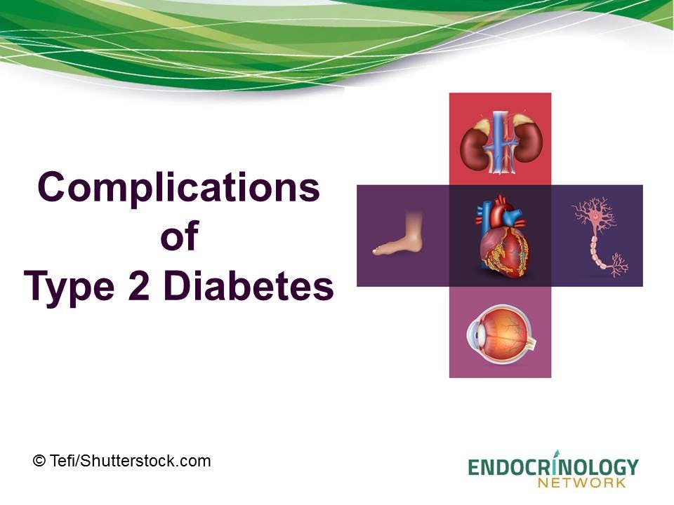 Complications of Type 2 Diabetes