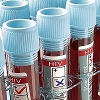 HIV, AIDS, blood test, dapivirine vaginal ring, 