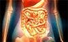 Researchers Report a High Rate of Concurrent Irritable Bowel Syndrome in Patients with Overactive Bladder 