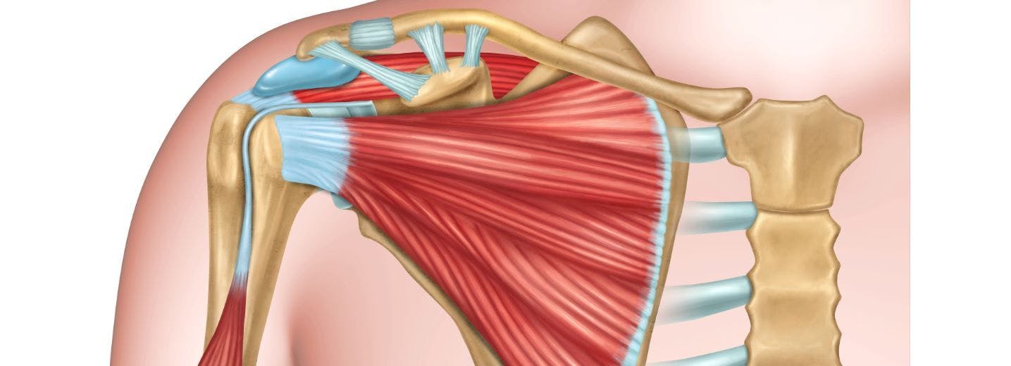 How long does a shoulder replacement last?