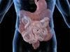 New Approach Offers Improved Outcomes Over Stool Transplant in Patients with C. difficile Infection