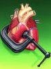 FDA Approves Edarbi to Treat Hypertension