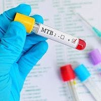 Study Gets to the Nitty-Gritty of HIV, Tuberculosis Coinfection