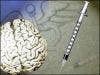 Developing Diabetes before Age 65 Increases Risk of Alzheimer's Disease