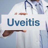 Sirolimus Showed Improvements in Patients with Active Noninfectious Posterior Uveitis