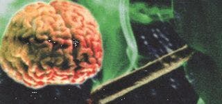 Marijuana Use Takes Toll on Adolescent Brain Function