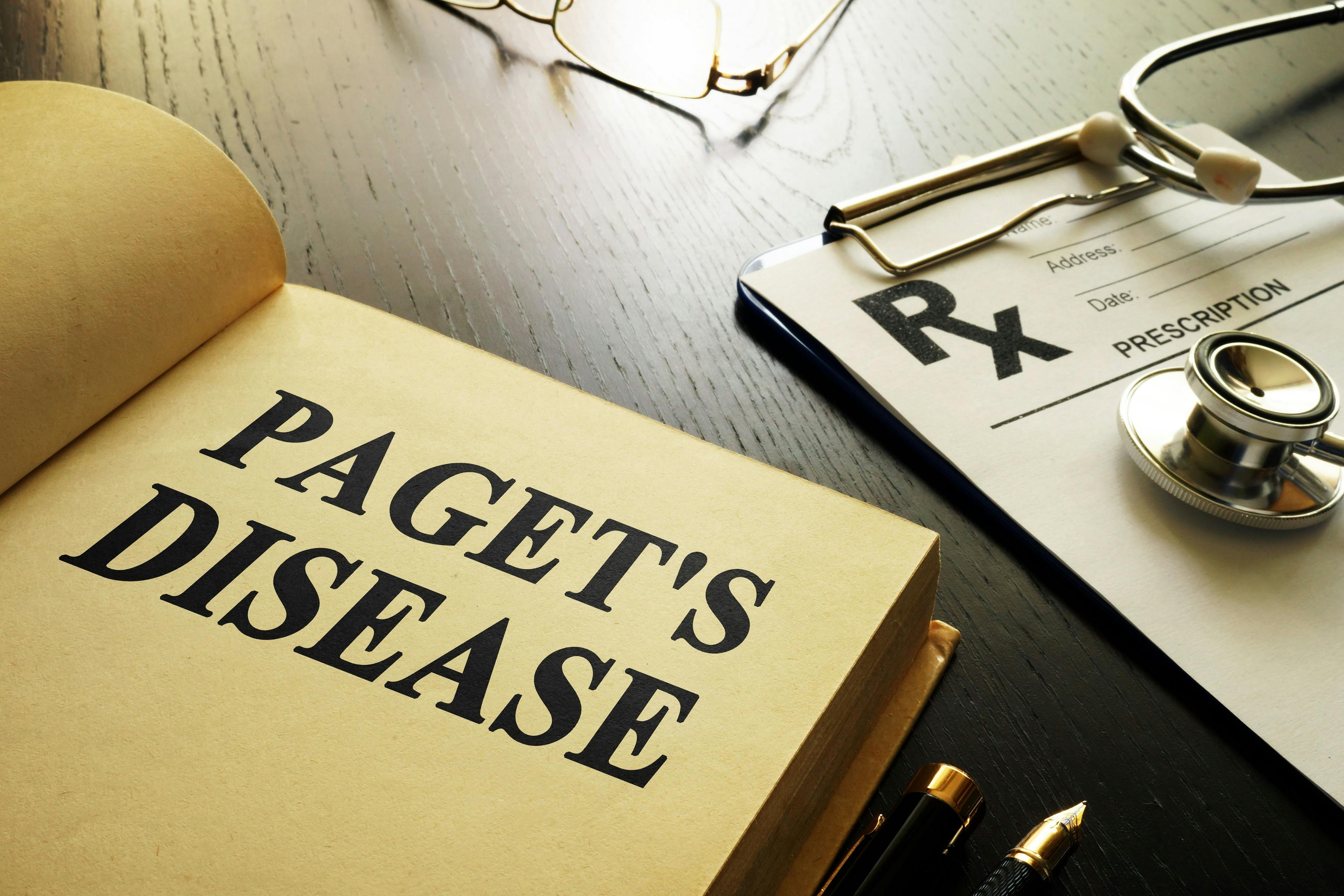Paget's Disease (©Designer491_AdobeStock)