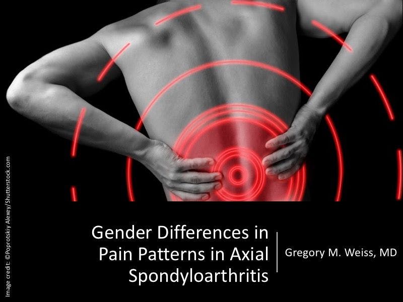 Gender Differences in Pain Patterns in Axial Spondyloarthritis