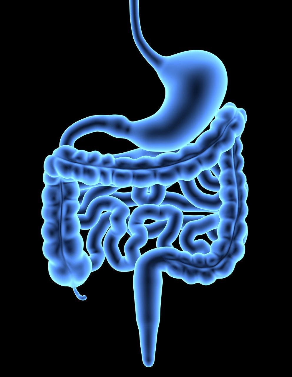 Immune Cells Linked to Development of Gastric Tumors in Peutz-Jeghers Syndrome