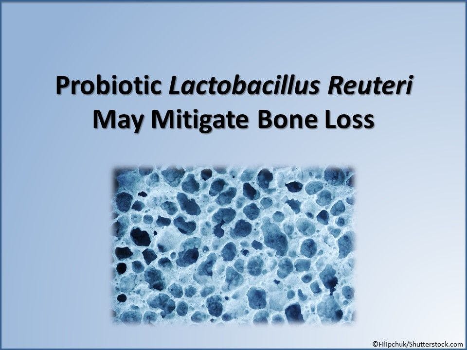Probiotic Lactobacillus Reuteri May Mitigate Bone Loss